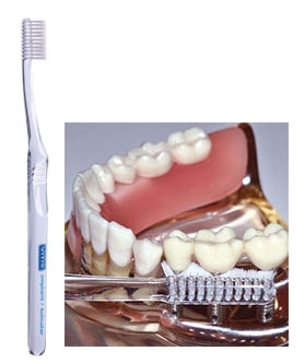 Implant tandenborstel angular 1 stuk Vitis